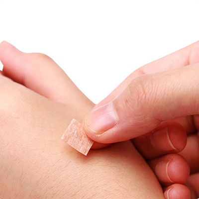 GB 2024-2016 Aghi da pressione per agopuntura 0,2 mm x 1,5 mm per apparecchiature di medicina cinese Proprietà Standard di sicurezza