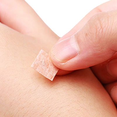 Sperimenta i Benefici degli Aghi Acu Press per l'Apparato di Medicina Cinese